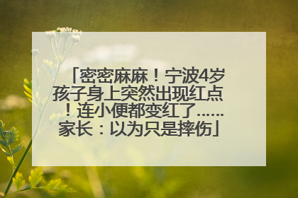 密密麻麻！宁波4岁孩子身上突然出现红点！连小便都变红了……家长：以为只是摔伤